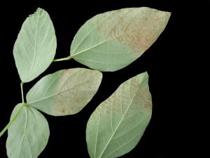 Soya - Insolation (coup de soleil)