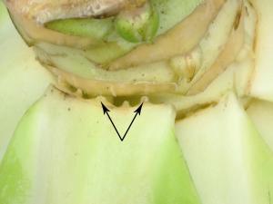 Chou pommé - Intumescence (oedème)