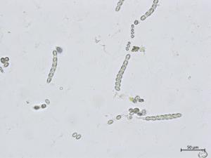 Phyllachora_maydis_2