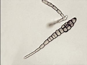 Alternaria_brassicae_3