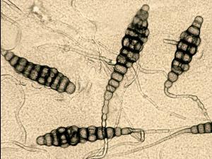 Alternaria_brassicae_4