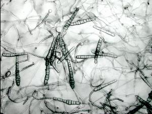 Alternaria_chrysanthemi-01_LQ