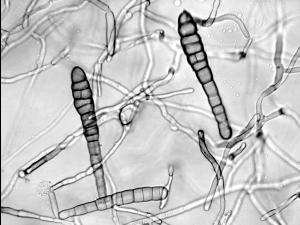 Alternaria_chrysanthemi-03_LQ