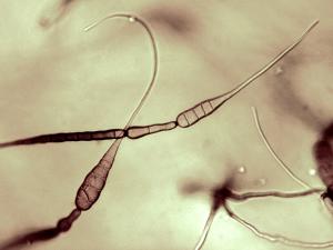 Alternaria_cichorii_2