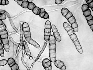 Alternaria_helianthi-02_LQ