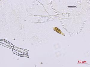 Alternaria_japonica_2