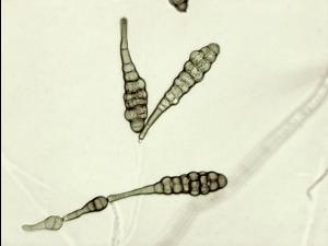 Alternaria_panax-05_LQ