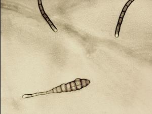 Alternaria_tagetica_3