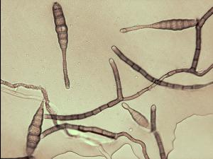 Alternaria_tagetica_2