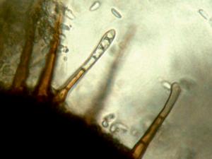 Chaetomella-05_LQ