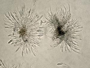 Colletotrichum_acutatum_1