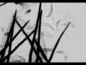 Colletotrichum_graminicola_1