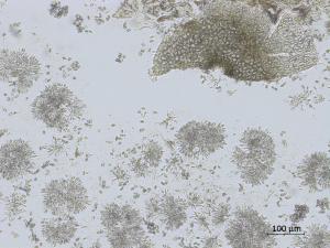 Coniella_diplodiella_2