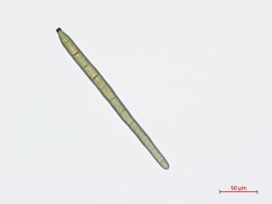 Corynespora_cassiicola_2