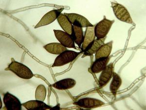 Exserohilum_pedicellatum_1