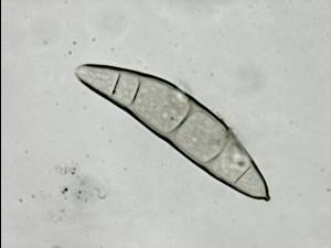 Exserohilum_turcicum_2