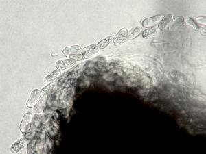 Cryptosporiopsis_coryli_1