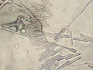 Cylindrocladium_sp_1
