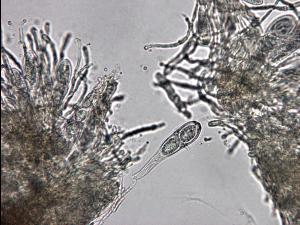 Didymascella_thujina_1