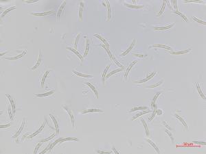 Fusarium_oxysporum_3