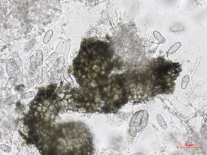 Leptosphaerulina_sp_1