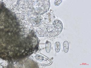 Leptosphaerulina_sp_3