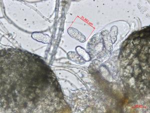 Leptosphaerulina_sp_4