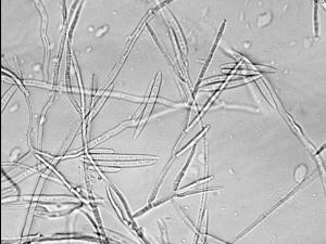 Fusarium_avenaceum_1