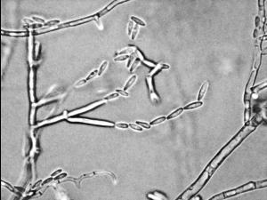 Fusarium_verticillioides_1