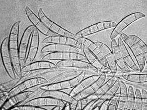 Fusarium_sambucinum_1