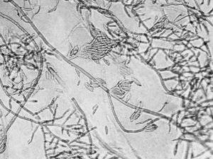 Fusarium_subglutinans_1