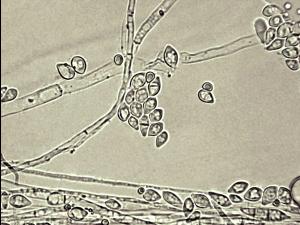 Fusarium_tricinctum_2