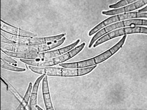 Fusarium_tricinctum_3