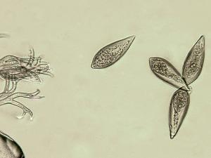 Peronospora_destructor_2