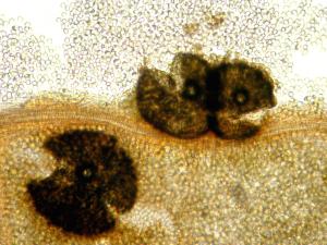 Phyllosticta_ampelicida_3