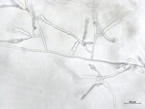 Rhizoctonia_sp_4