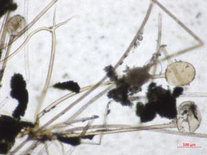 Rhizopus_sp_3