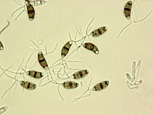 Truncatella_sp_1
