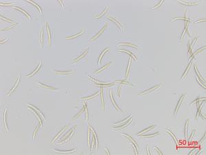 Fusarium_virguliforme_1