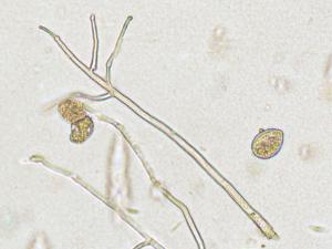 Phytophthora_infestans_4