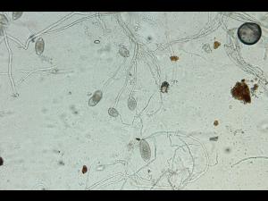 Phytophthora_infestans_6
