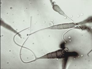 Alternaria_cichorii_6