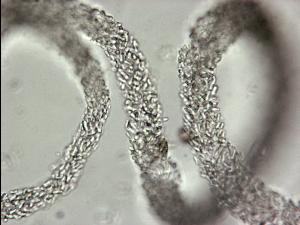 Ascochyta_sp_2