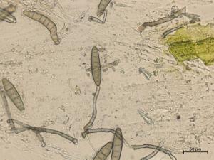 Bipolaris_sorokiniana_5