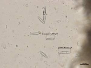 Botryosphaeria_dothidea_3