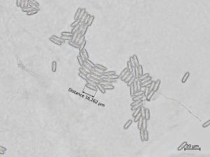 Colletotrichum_siamense_2