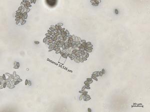 Coniella_diplodiella_3