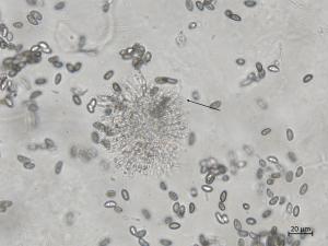 Coniella_diplodiella_4