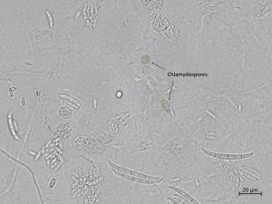 Fusarium_oxysporum_8