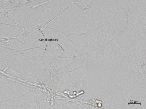 Fusarium_oxysporum_9